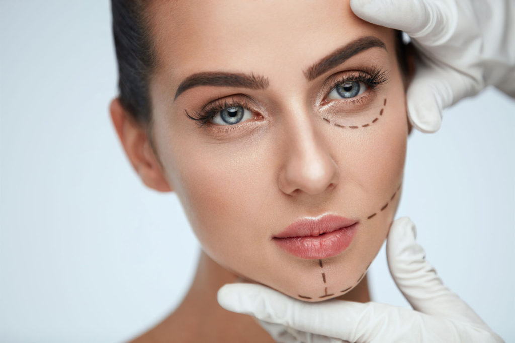 Blepharoplasty